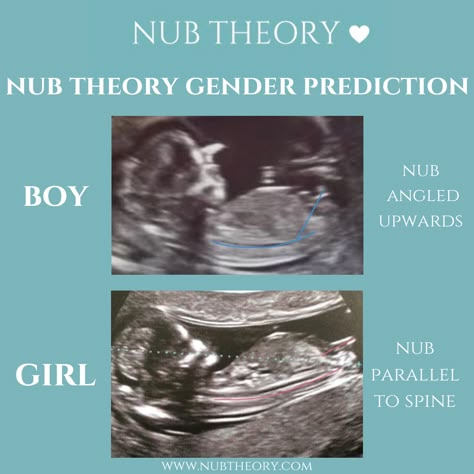 Ultrasound Gender Prediction, Baby Gender Predictor, Pregnancy Gender Prediction, Ultrasound Gender, Nub Theory, Lets Make A Baby, Baby Gender Prediction, Mommy Hacks, Pregnancy Gender