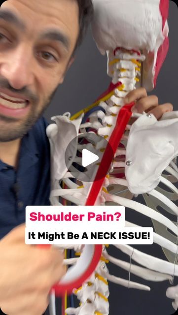 Stiff Shoulder And Neck, Rotator Cuff Muscles, Rotator Cuff Pain, Radial Nerve, Muscles Of The Neck, Shoulder Problem, Shoulder Mobility, Neck And Shoulder Pain, Rotator Cuff