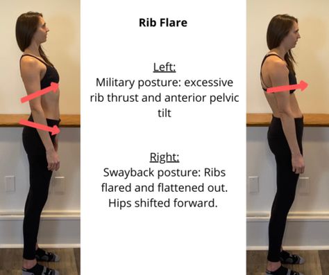 What is Rib Flare? Rib flare is a term that often gets thrown around in the rehab world and most of the women I see ask me what the heck it means. 🙂 The confusing part is that it can refer to two different things. One is rib positioning, and one is rib angle. So … What is Rib Flare? Read More » Pectus Excavatum, Better Posture Exercises, Rib Flare, Posture Fix, Diastasis Recti Exercises, Pelvic Tilt, Muscle Imbalance, Ribbed Flares, Getting A Tattoo