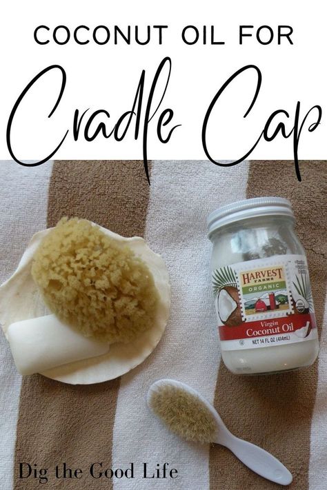 Coconut Oil For Cradle Cap, Essential Oils For Cradle Cap, Natural Cradle Cap Remedy, Baby Dry Scalp, Cradle Cap Remedies, Flakey Scalp, Baby Cradle Cap, Scalp Moisturizer, Benefits Of Coconut