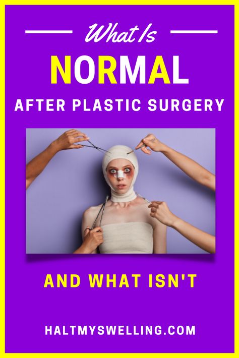 So, you got your plastic surgery and you are headed home or to your recovery house with post-op instructions in-hand.  You are told to let your doctor know immediately if you have warning signs after plastic surgery (the things that are not normal), and they give you a list. Beyond that you are left wondering if all of the other sensations you feel are normal or not. You don't want to call them every 10 minutes to ask, but you still worry if what you are experiencing is ok. Plastic Surgery Recovery, What Is Normal, Care Hospital, Reconstructive Surgery, Surgery Recovery, Nursing Study, The Kardashians, Post Op, Tummy Tucks