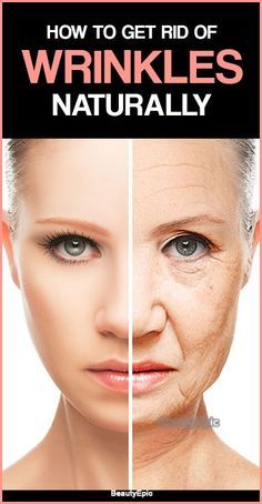 how to get rid of wrinkles How To Get Rid Of Wrinkles, Home Remedies For Wrinkles, Acne Routine, How To Remove Warts, Brown Spots On Skin, Spots On Skin, Remove Warts, Skin Care Routine For 20s, Erase Wrinkles