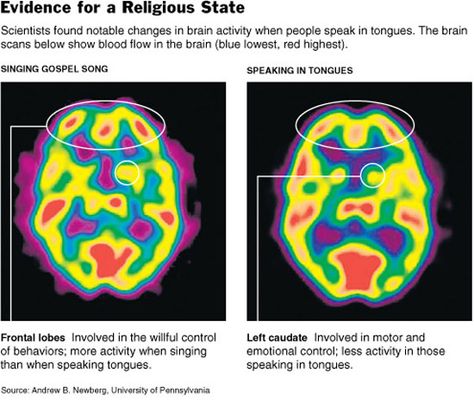 The following brain scan shows that ‘speaking in tongues’ uses different parts of the brain to normal language. Joseph Prince, Speaking In Tongues, Born Again Christian, Brain Scan, Personal Prayer, Notes Online, Religious People, Gift From Heaven, Sermon Notes