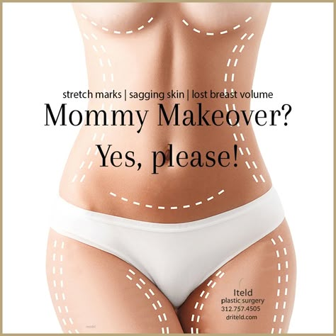 Stretch marks? Sagging skin? Lost breast volume? If you’ve completed your family, it might be the right time to speak with us about a mommy makeover. Call 312.757.4505 to schedule your confidential consult. #mommymakeover #plasticsurgery #chicagoplasticsurgeon #boardcertified Post Op Mommy Makeover, Breast Reduction Aesthetic, Plastic Surgery Vision Board, Plus Size Mommy Makeover Surgery, Plastic Surgery Mommy Makeover, Mommy Makeover Surgery Before And After, Mommy Makeover Surgery, Tighten Loose Skin, Plastic Surgery Procedures