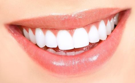 Natural Teeth Whitening Diy, Pretty Teeth, Teeth Whitening Remedies, Teeth Whitening Diy, Beautiful Teeth, Laser Teeth Whitening, Pasta Dental, Perfect Teeth, Dental Veneers