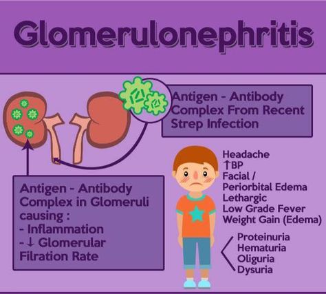 Glomerulonephritis Renal Nursing, Peds Nursing, Nursing School Organization, Nursing Study Tips, Medical Assisting, Pediatric Nurse Practitioner, Bells Palsy, Student Tips, Nursing Student Tips