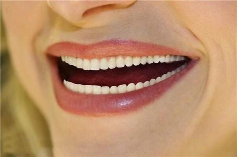 Smile design! You can NEVER have too many teeth! Coconut Oil Toothpaste Recipe, Coconut Oil Toothpaste, Teeth Aesthetic, Healthy Holistic Living, Teeth Whitening Remedies, Dental Veneers, Smile Teeth, Dental Crowns, Natural Teeth Whitening