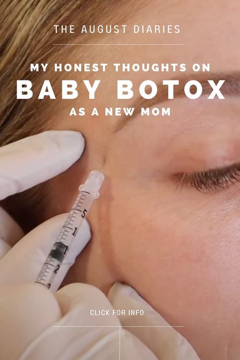 BABY BOTOX 101 AS NEW MOM // Style and beauty blogger Jill Lansky takes you through her entire experience getting baby botox injections for the first time in a dermatologist's office in Vancouver, Canada. As she's postpartum and prioritizes natural aging, her video shows her before and after pics, hesitations, care and maintenance, doctor's appointment, facial expressions, and more! READ THE POST for DETAILS. Baby Botox Before And After, Jill Lansky, New Mom Style, August Diaries, Botox Before And After, Before And After Pics, Botox Injections, Natural Aging, Doctor Appointment