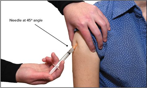 Figure. Subcutaneous injection into the deltoid area Injection Needle, Subcutaneous Injection, Med Surg Nursing, 45 Degree Angle, Med Surg, Study Tips, Left Hand, Nursing, Health