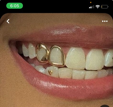 Gold Grill Black Woman, Girl Grills, Bottom Grills, Artist Persona, Grillz Girls Teeth, Open Face Heart Grillz, Girls With Grills, Silver Open Face Grillz, Gold Outline Tooth Grill