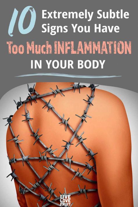 Inflammation is the backbone of chronic disease. Here's how to reduce chronic inflammation throughout your body and boost your immune system! Muscle Gain Meal Plan, Diet Schedule, Healthy Heart Tips, Blood Sugar Diet, Unhealthy Diet, Muscle Gain, Nose Shapes, Boost Your Immune System, Health Research