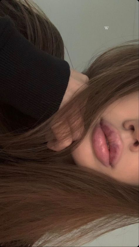 Lips Inspiration, Botox Lips, Lips Photo, Juicy Lips, Lip Injections, Perfect Lips, Lip Fillers, Plastic Surgery, Pretty Face