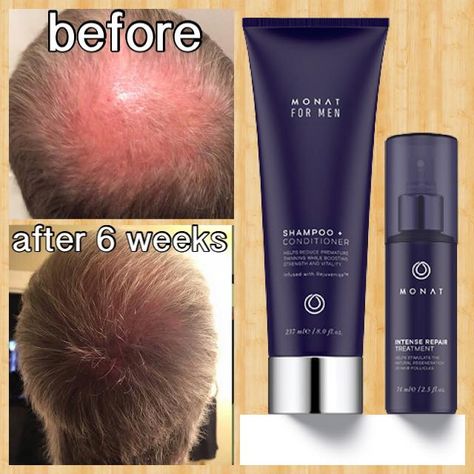 Six weeks of using MONAT Global Men's line. Monet Hair Products, Aging Hair Care, Monat Before And After, Regrow Hair Naturally, Losing Hair, Hair Growth For Men, Anti Aging Hair, Regrow Hair, Monat Hair