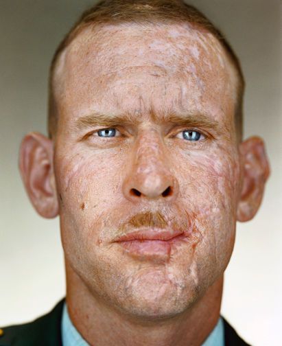 Martin Schoeller, Delta Green, Skin Grafting, 얼굴 드로잉, Face Reference, Military Heroes, Real Hero, Shooting Photo, American Heroes