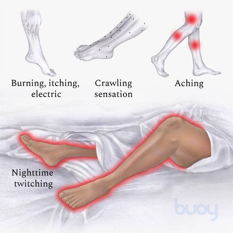 Restless Legs Syndrome | Symptoms, Causes, and Treatments Restless Legs Syndrome, Restless Leg, Restless Legs, Restless Leg Syndrome, Sleeping Habits, Cold Therapy, How To Stay Awake, Aging Skin Care, Lifestyle Changes