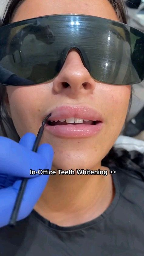 Home made natural teeth whitening remedies for brighter smile | prevent cavity and tooth decay Teeth Whitening At Home, Natural Teeth Whitening Remedies, Teeth Whitening Dentist, Heart Diet, Teeth Whitening Remedies, Teeth Whitening Diy, Whiter Teeth, Grills Teeth, Yellow Teeth