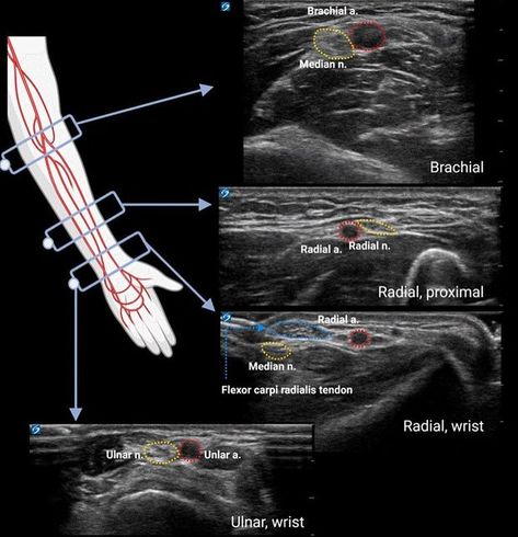 Abdomen Ultrasound Protocol, Ultrasound Technician School, Diagnostic Medical Sonography Student, Ultrasound Physics, Cardiac Sonography, Vascular Ultrasound, Sonography Student, Medical Sonography, Ultrasound Sonography