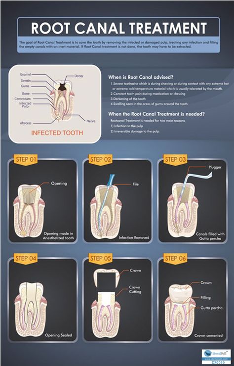 dentalsell - The World's Leading Suppliers of Dental Posters,Medical Posters,Ground Sections of Teeth,Patient Educational Models,Clinic Posters! Sri Satya, Dental Wallpaper, Dental Assistant Study, Dental Doctor, Dental Images, Dental Posts, Dental Posters, Dentist Clinic, Dental Anatomy