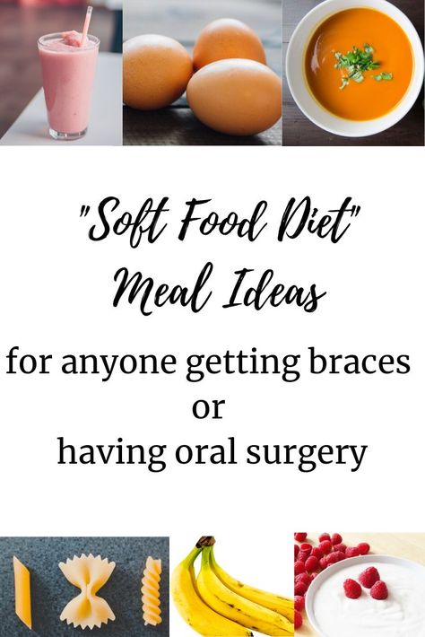 Soft Food School Lunches, Meals For New Braces, Easy Meals For Braces, Brace Friendly Recipes, Post Braces Food, Braces Lunch Ideas, Meals For Braces Dinners, Soft Foods To Eat After Getting Braces, After Braces Food