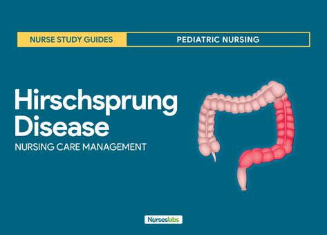 Nursing care management and nursing care planning for patients with Hirschsprung disease (aganglionic megacolon) -- persistent conspitation resulting from partial or complete intestinal obstruction of mechanical origin. Hirschsprungs Disease, Care Management, Nursing Care Plan, Nursing Study, Nursing Care, Care Plans, Stools, Nursing, Disease