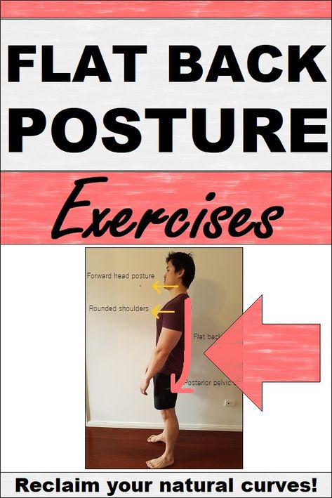 Flat back posture exercises and stretches Flat Back Exercise, Flat Back Syndrome Exercises, Back Posture Exercises, Shoulder Blade Muscles, Posture Fix, Increase Height Exercise, Soft Summer Color Palette, Back Posture, Fix Your Posture