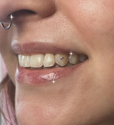 A cute simple crystal on the canine ✨✨ I promise I still do simple tooth gems!! Single crystals are honestly my favorite sets. They’re super quick and add a fun little sparkle to your smile 😊 • ♡ ♡ ♡ • DM for any questions!! 🧸💗✨ 📍 Hammond, IN ✿ Book an appointment in my bio! ✿ Certified lead-free crystals ✿ Top quality gold gems ✿ No drilling, no holes, no pain! ✿ 3-6 month longevity ✿ 1 month guarantee • #toothgems #chicagotoothgems #nwitoothgems #indianatoothgems #nwitoothgemtech #chi... Tooth Gems Simple, Tooth Gem, Glow Up?, Sparkle, Gems, Crystals