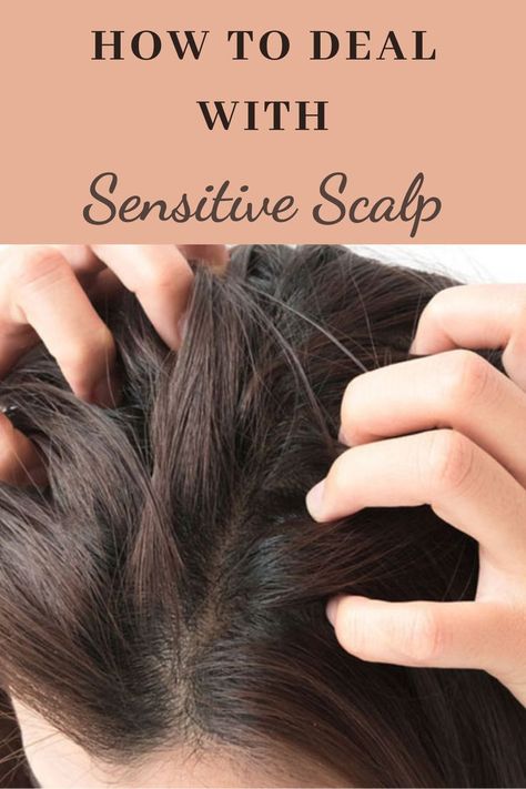 Hair Products For Sensitive Scalp, Best Shampoo For Sensitive Scalp, Best Shampoo And Conditioner For Dry Scalp, Hairstyles For Sensitive Scalp, Sensitive Scalp Remedies, Sores On Scalp, Oils For Dandruff, Scalp Itch, How To Look Attractive