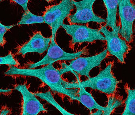 Nikon Small World, Henrietta Lacks, Microscopic Photography, Micro World, Short Wave, Under A Microscope, Microscopic Images, Cell Line, University Of British Columbia