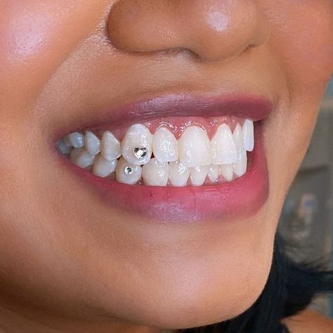 Piercing no dente: item fashionista ou delírio coletivo? Ao que parece, o acessório está de volta com tudo. Se você foi adolescente nos anos 80, 90 ou 2000’s, com certeza foi impactada por essa tendência que brilhava na boca dos jovens daquela época. Não era um piercing de verdade, claro, apenas uma pequena joia ou strass – e que chamava atenção de quem olhava. #piercing | tooth gems | #acessorios | tooth piercing | piercing tooth gems | #toothgems | pedras nos dentes | #piercingnodente Dental Jewelry, Diamond Teeth, Swarovski Heart, Tooth Gem, Teeth Jewelry, Gem Diamonds, Natural Teeth, Beauty Services, Tooth Fairy