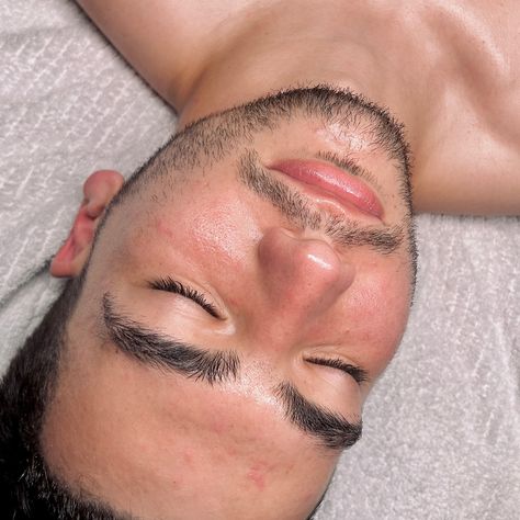 A facial with me goes a little like this….😶‍🌫️ Book with the link in bio or DM for skincare consultation/questions ❤️��‍🔥💆🏻‍♀️💆🏻‍♂️✨🌿 . . . #tampafacials #tampathingstodo #tampaspa #facialsstampa #esteticatampa #acnefacial Acne Facial, Facial, Spa, Things To Do