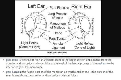 Tympanic Membrane - At the centre of the concavity the deepest point is called the umbo - It is attached superiorly to the scutum and inferiorly to the tympanic annulus Tympanic Membrane, Line Diagram, The Tenses, Lara Croft, Medicine, Quick Saves