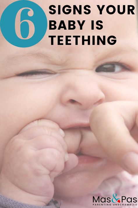 When it comes to this ‘first’ there’s a real dread that teething will be turn your baby into a cranky red-cheeked dribbler and throw any routine or rest you have worked so hard to get, completely up in the air. Our tell-tale signs that baby is teething can help you to be prepared when the teeth do start to arrive. #parentingtips #babyteething #parentingbaby When Do Babies Start Teething, Teething Baby Remedies, Baby Teething Chart, Smile Tips, Teething Signs, Baby Remedies, Teething Symptoms, Teething Babies, Teething Remedies