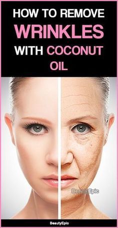 Coconut Oil Facial, Wrinkle Remedies, Coconut Oil Skin Care, Pele Natural, Anti Wrinkle Skin Care, Skin Care Wrinkles, Coconut Oil For Skin, Wrinkle Cream, Les Rides