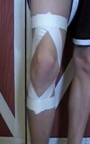 How to Tape a Knee Knee Taping, Knee Pain Relief Remedies, Aching Knees, K Tape, Fake Injury, Healthy Heart Tips, Pain Relief Remedies, Knee Pain Relief, Sports Hairstyles