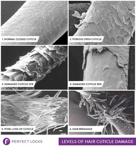 Hair Under Microscope, Apple Cider Vinegar Hair Rinse, Vinegar Hair Rinse, Apple Cider Vinegar For Hair, Hair Science, Hair Facts, Hair Structure, Breaking Hair, How To Grow Natural Hair