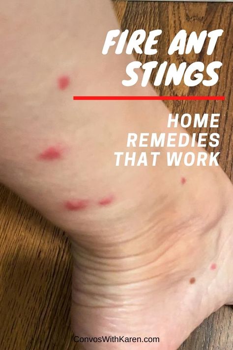 Fire Ant Bites Relief, Ant Bites Relief, Red Bug Bites, Natural Remedies For Ants, Home Remedies For Ants, Ant Remedies, Ants In Garden, Kill Fire Ants, Fire Ant Bites