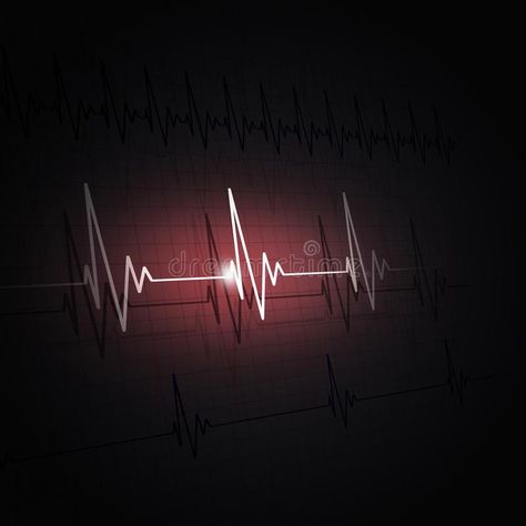 Rhythm of a Heart ecg. Heart pulsating ecg rhythm graph dark red background , #Sponsored, #ecg, #pulsating, #Rhythm, #Heart, #rhythm #ad Brain Neurons, Heart Rhythm, Dark Red Background, About Heart, Heart Rhythms, Heart Strings, Story House, Background Illustration, Red Background