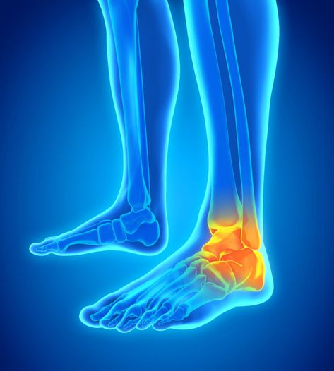 Foot-Ankle Pain | Foot-Ankle Injury | Foot Surgeon | Foot Surgery Dadar Mumbai, Achilles Tendon Ruptures, Ankle Ligaments, Chronic Lower Back Pain, Ligament Injury, Lower Back Pain Exercises, Back Pain Remedies, Ankle Pain, Foot Injury