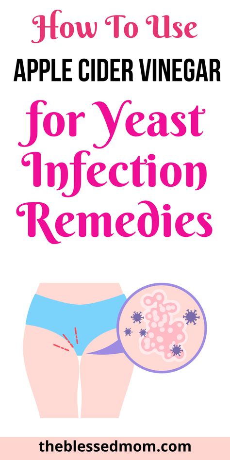 how to use apple cider vinegar for yeast infection remedies. Recurrent Yeast Infections, Natural Remedies For Yeast Infection In Women, Natural Remedies For Yeast Infection Diy, Home Remedies For Yeast Infection Itch, Natural Yeast Infection Remedies, How To Get Rid Of A Yeast Infection Fast, Home Remedy For Yeast Infection In Women, How To Get Rid Of Yeast Infection Fast, Yeast Infection Remedies Fast At Home