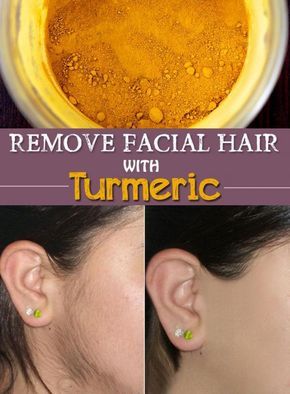 Does Turmeric Stop Hair Growth?. Turmeric can stop hair growth. This usually happens when turmeric hair removal is performed frequently, and works best with facial hair.Turmeric has... Turmeric Hair Removal, To Remove Facial Hair, Unwanted Facial Hair, Facial Hair Removal, Grow Hair Faster, Unwanted Hair Removal, Unwanted Hair, Body Hair, Facial Hair