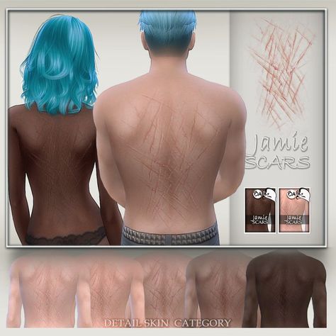 Sims 4 Cc Skin Details Scar, Top Surgery Scars Sims 4 Cc, Ts4 Scars Cc, Sims 4 Imperfections Cc, Sims 4 Injury, Sims 4 Bruising, Sims 4 Cc Scars Arm, Sims 4 Cc Blood Stains, Sims 4 Cc Scars Face