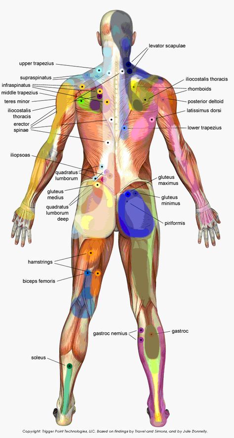 Trigger Points from the back Head Diagram, Punkty Spustowe, Autogenic Training, Body Guide, Trigger Point Massage, Bolesti Chrbta, Trigger Point Therapy, Reflexology Massage, Trigger Point