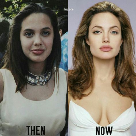 Angelina Jolie Antes e Depois Angelina Jolie Modeling, Angelina Jolie Surgery, Angelina Jolie Nose, Angelina Jolie Plastic Surgery, Celebs Without Makeup, Angelina Jolie Photos, Celebrity Plastic Surgery, Celebrities Then And Now, Celebrities Before And After