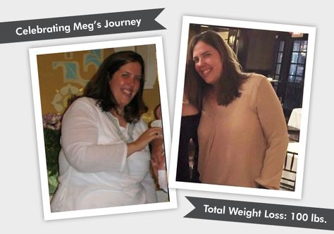 We are celebrating Meg's Before & After Lap-Band WLS. Meg has lost 100 pounds and feels great. Read her WLS journey and what her daily motto is! Lap Band, Gastric Band, Lost 100 Pounds, Patient Experience, Feeling Great, Life Style, Healthy Life, Lost, Band