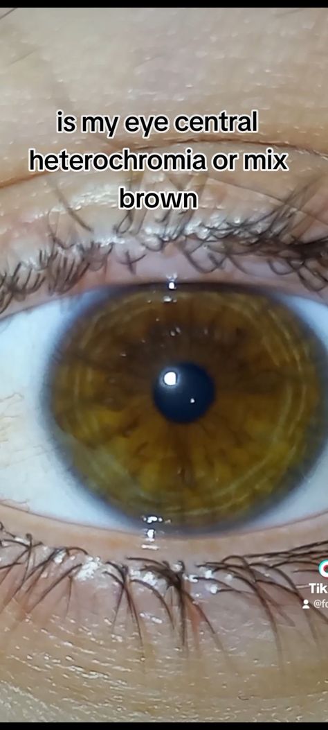 #eyes Central Heterochromia, Brown Eyes, Quick Saves