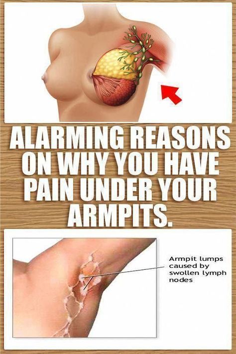 Do You've A Lump On your Neck, Back, Or Behind Your Ear? This can be What It Means #Gemsandminerals #LumpUnderSkinOnHead #PinkLumpOnSkin #SoftLumpOnSkin #RedBumpsOnSkin #LumpOnRightSideOfNeck #LumpUnderSkinOnArm #LumpOnHead Lump In Armpit, Armpit Lump, Small Bumps On Face, Lump Behind Ear, Back Pimples, Skin Bumps, Lymph Nodes, 5 Months, Herbal Remedies