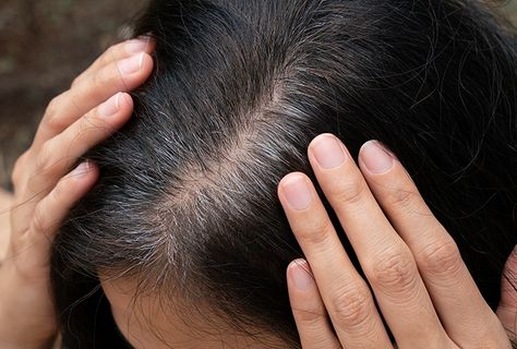 Home Remedies for Premature Graying of Hair | Top 10 Home Remedies Grey Hair Home Remedies, Hair Turning White, Premature Grey Hair, Prevent Grey Hair, Top 10 Home Remedies, Bottle Blonde, Ayurvedic Oil, Dramatic Hair, Poor Nutrition