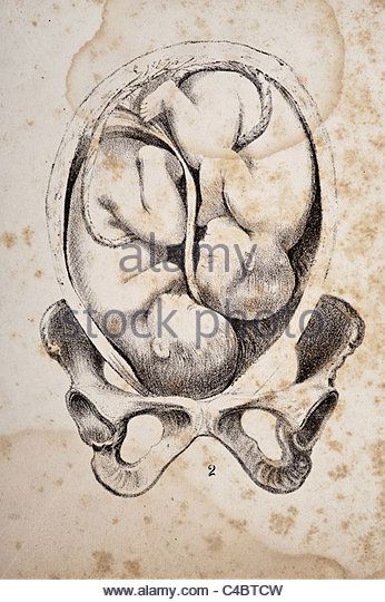 Twins In Womb Art, Twins In The Womb, Organ Anatomy, Handmaids Tale, Birth Art, Fetal Position, Pregnancy Art, Mother Art, Figure Sketching