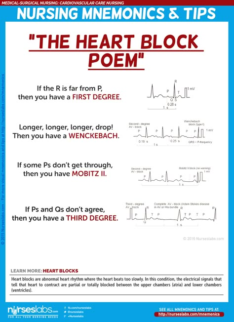 Heart Blocks: “The Heart Block Poem” via http://nurseslabs.com/cardiovascular-care-nursing-mnemonics-tips/ Cardiovascular Disease Nursing, Ekg Mnemonics, Heart Valves Mnemonics, Same Day Surgery Nurse Tips, Heart Blocks Nursing, Siadh Nursing Mnemonic, Blood Flow Through The Heart Mnemonic, Pcu Nurse Tips, Heart Sounds Nursing