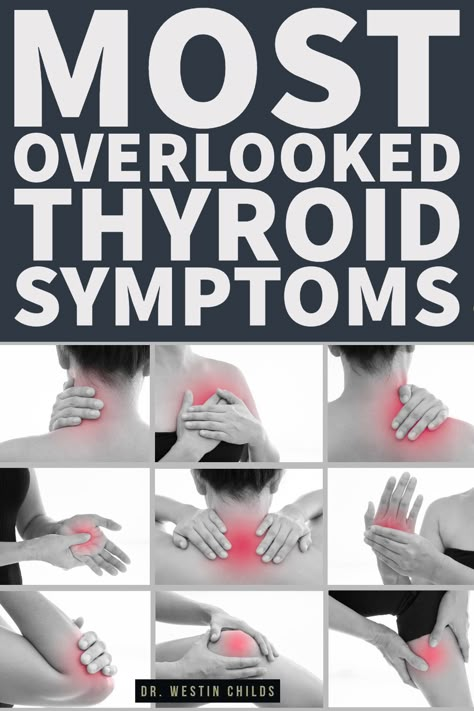 Thyroid Remedies, Thyroid Healing, Low Thyroid, Thyroid Symptoms, Hashimotos Disease, Thyroid Medication, Thyroid Issues, Thyroid Function, Thyroid Hormone